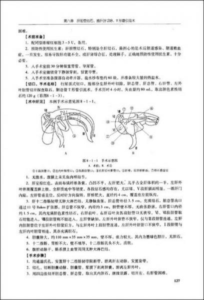 肝胆胰外科复杂手术技巧