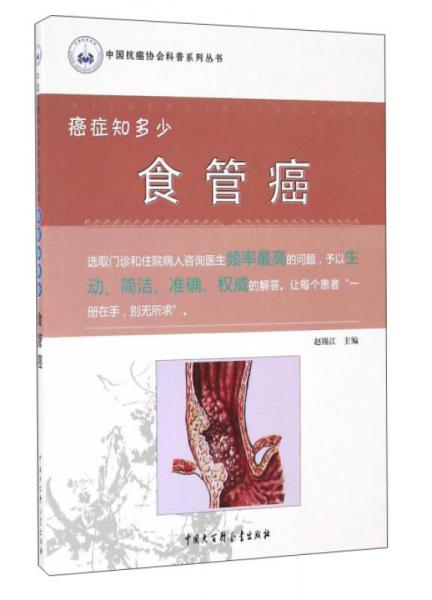 癌癥知多少：食管癌