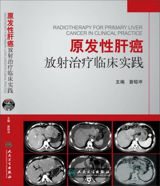 原发性肝癌放射治疗临床实践