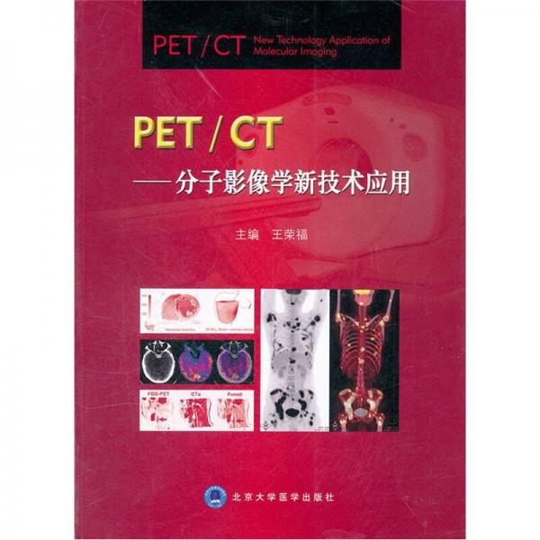 PET/CT：分子影像学新技术应用