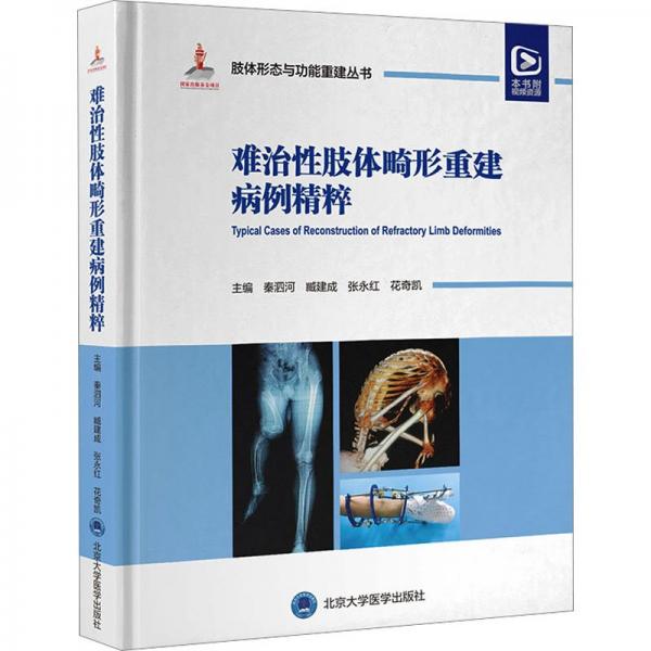 難治性肢體畸形重建病例精粹