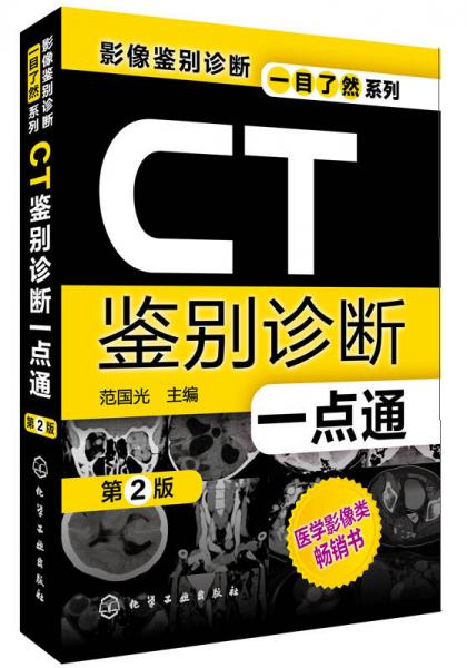 影像鉴别诊断一目了然系列：CT鉴别诊断一点通（第2版）