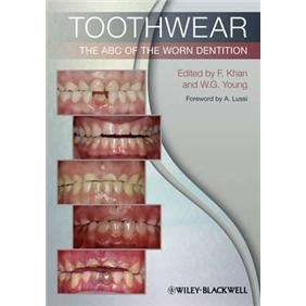 Toothwear:TheABCoftheWornDentition