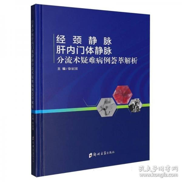 经颈静脉肝内门体静脉分流术疑难病例荟萃解析