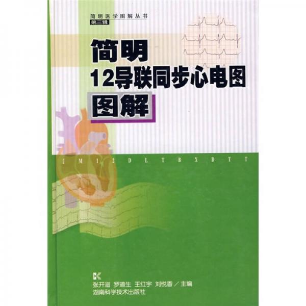 簡明12導聯(lián)同步心電圖圖解