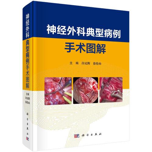 神經(jīng)外科典型病例手術(shù)圖解