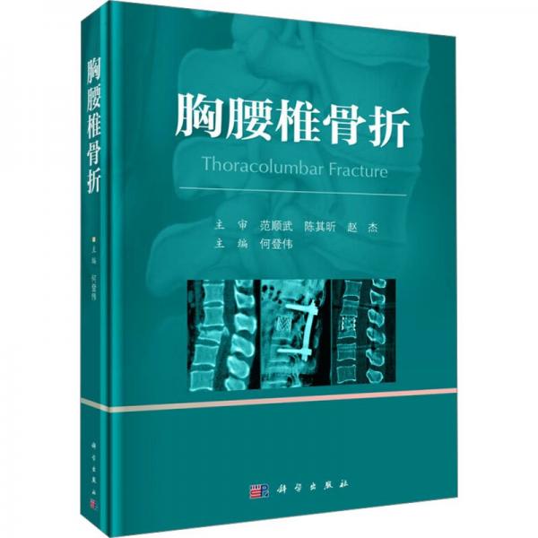 胸腰椎骨折 何登偉 編
