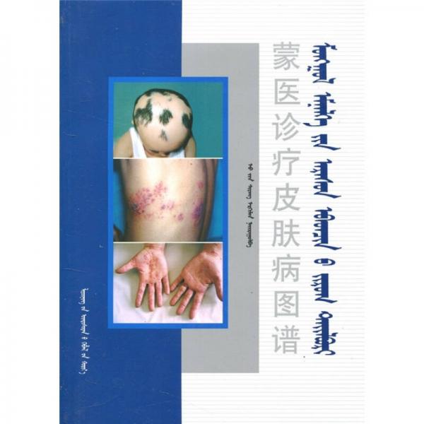 蒙醫(yī)診療皮膚病圖譜