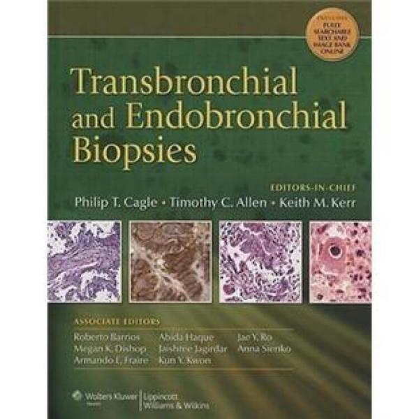 TransbronchialandEndobronchialBiopsies[支气管活检]