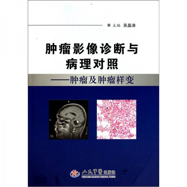 肿瘤影像诊断与病理对照.肿瘤及肿瘤样变