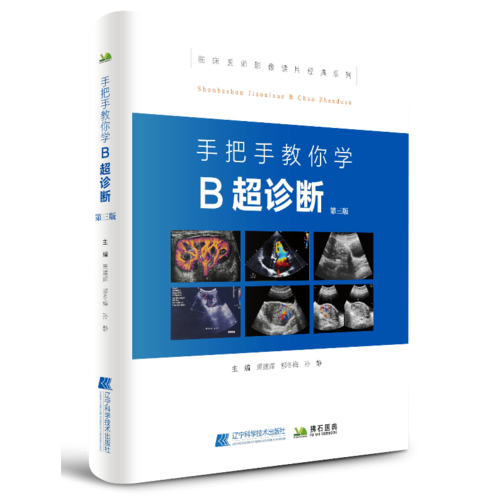 手把手教你學(xué)B超診斷（第三版）