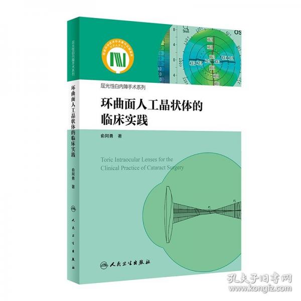 環(huán)曲面人工晶狀體的臨床實(shí)踐