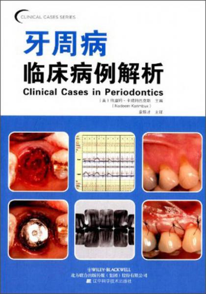 口腔临床病例解析丛书：牙周病临床病例解析