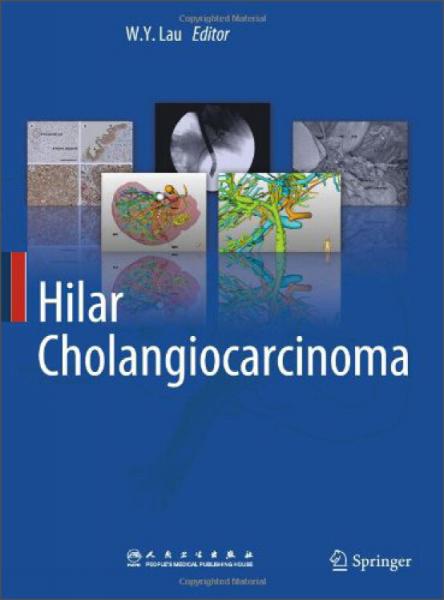 HilarCholangiocarcinoma