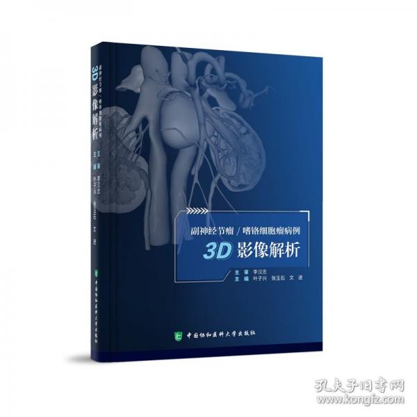 副神經(jīng)節(jié)瘤/嗜鉻細胞瘤病例3D影像解析