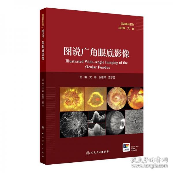 图说广角眼底影像