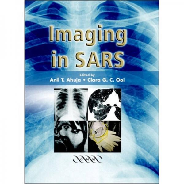 Imaging in SARS[非典的醫(yī)學成像]