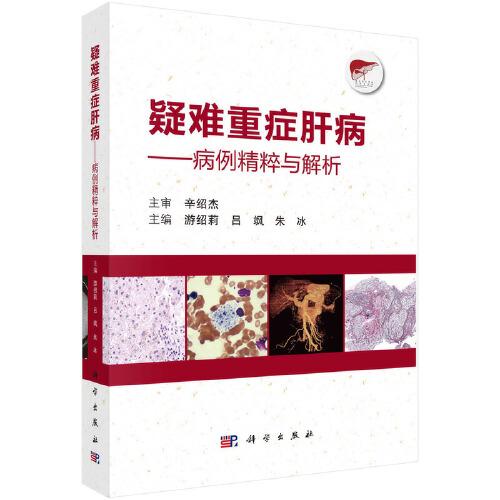 疑難重癥肝?。翰±馀c解析  游紹莉  呂颯  朱冰著