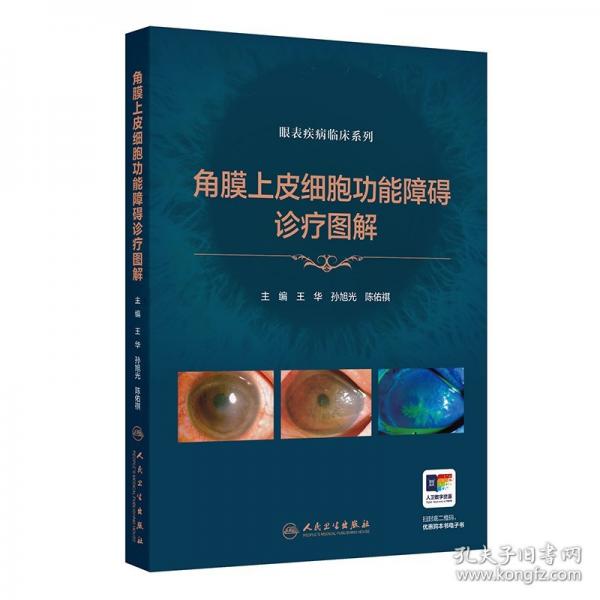 角膜上皮细胞功能障碍诊疗图解