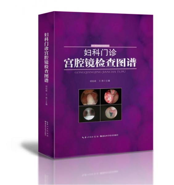 妇科门诊宫腔镜检查图谱