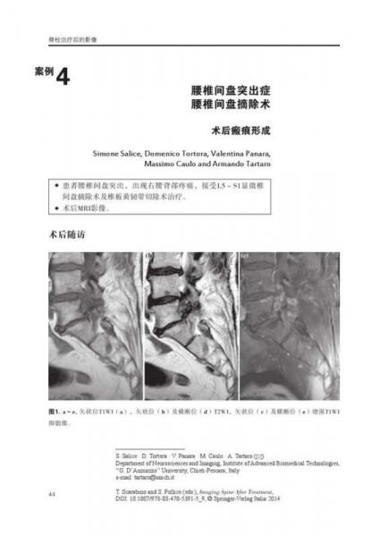 脊柱治疗后的影像