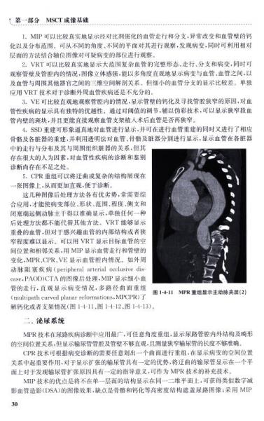 多层螺旋CT成像技术/影像技术实验教材