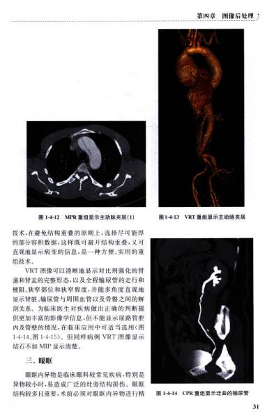 多层螺旋CT成像技术/影像技术实验教材