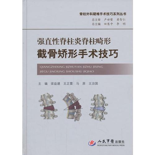 强直性脊柱炎脊柱畸形截骨矫形手术技巧