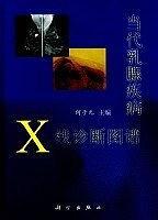 當(dāng)代乳腺疾病X線診斷圖譜