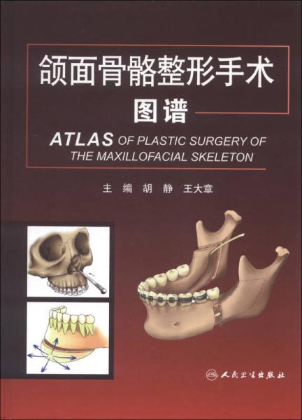 颌面骨骼整形手术图谱