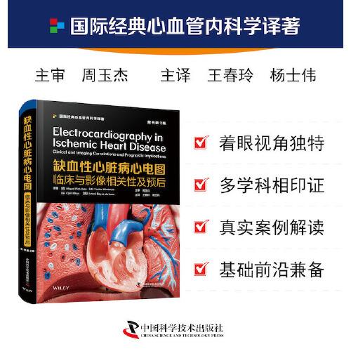 缺血性心脏病心电图：临床与影像相关性及预后