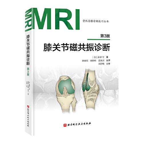 膝关节磁共振诊断（第3版）