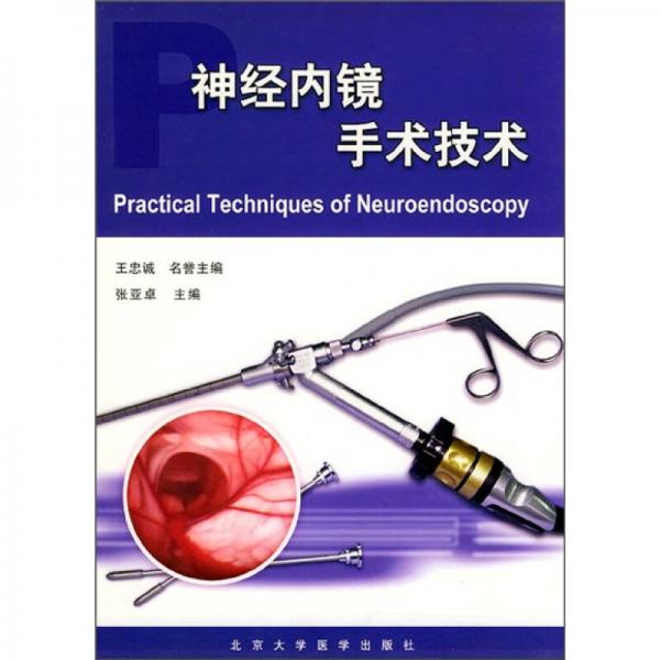 神经内镜手术技术
