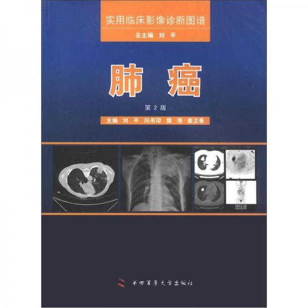 实用临床影像诊断图谱：肺癌（第2版）