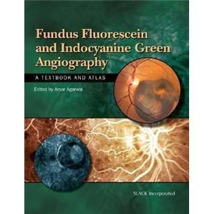 FUNDUSFLUORESCEINNINDOCYANINEGREEN