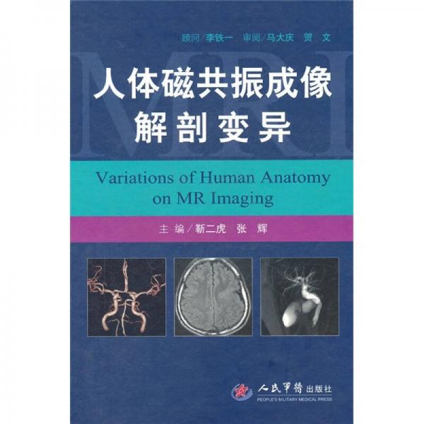人體磁共振成像解剖變異
