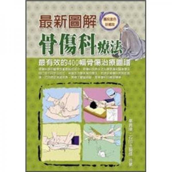 最新圖解骨傷科療法: 最有效的400幅骨傷治療圖譜
