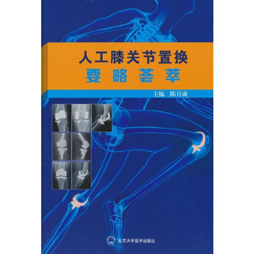 人工膝關(guān)節(jié)置換要略薈萃
