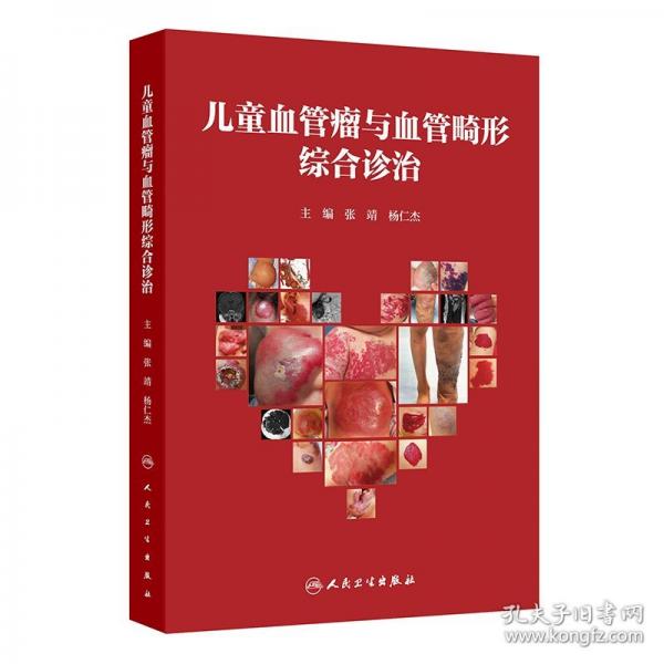 兒童血管瘤與血管畸形綜合診治