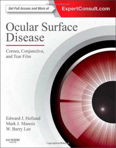 Ocular Surface Disease, First Edition
