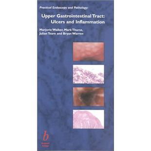 UpperGastrointestinalTract:UlcersandInflammation