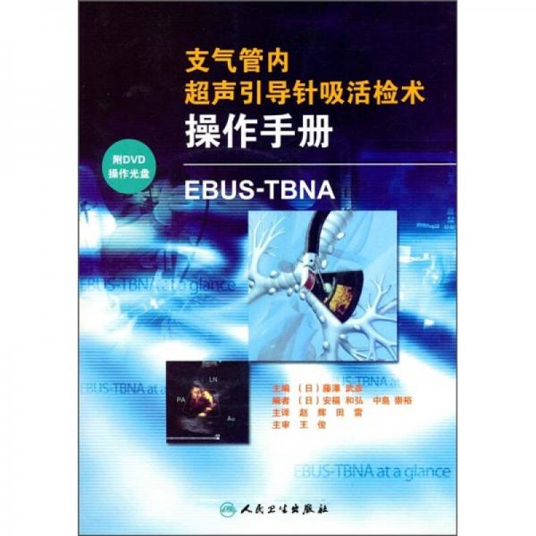 支气管内超声引导针吸活检术操作手册：EBUS-TBNA（翻译版）