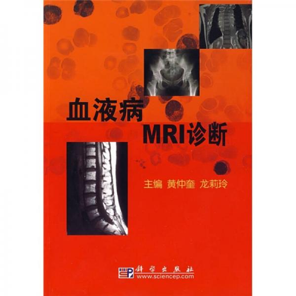 血液病MRI診斷