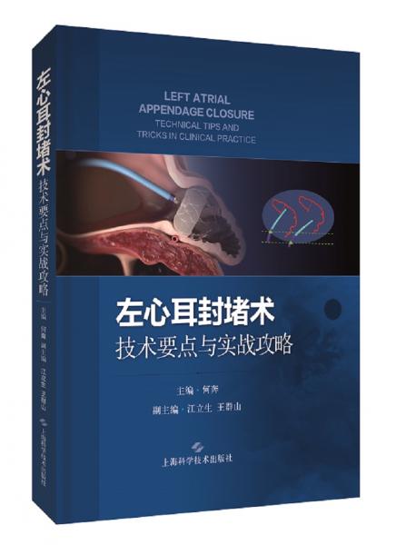 左心耳封堵術(shù)：技術(shù)要點與實戰(zhàn)攻略