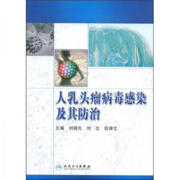 人乳头瘤病毒感染及其防治