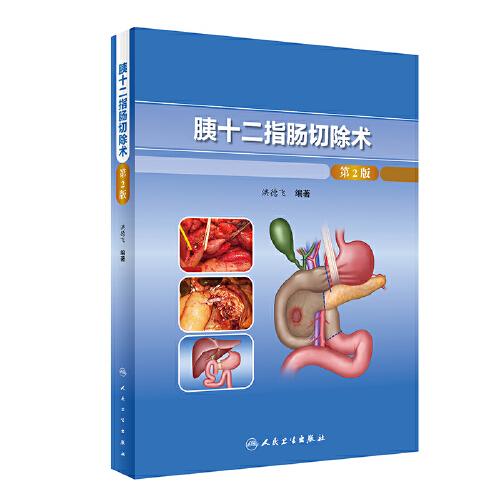 胰十二指腸切除術(shù)（第2版）