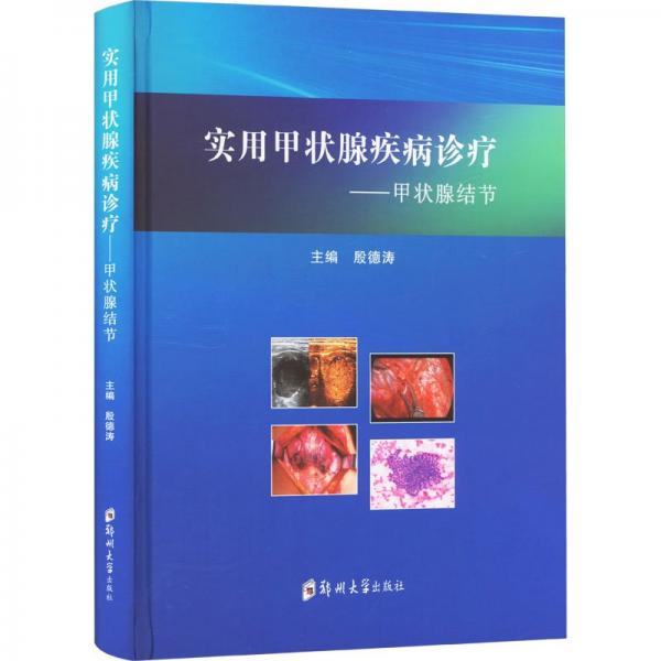 實用甲狀腺疾病診療 甲狀腺結(jié)節(jié)