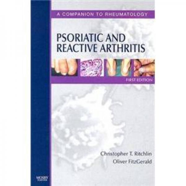 Psoriatic and Reactive Arthritis银屑病和反应性关节炎:风湿病学指南丛书