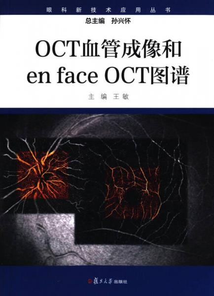 眼科新技术应用丛书：OCT血管成像和enface OCT图谱（平装版）