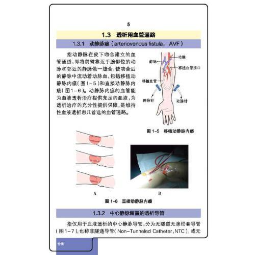 儿童血管通路管理